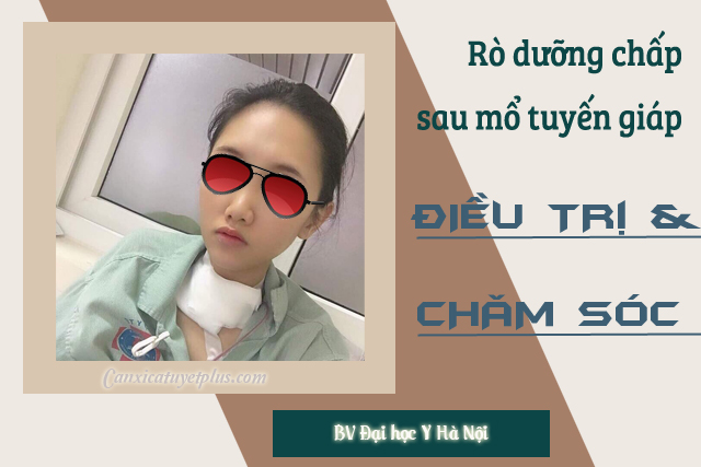 Rò Dưỡng Chấp Sau Mổ Tuyến Giáp: Nguyên Nhân, Triệu Chứng Và Giải Pháp Điều Trị Hiệu Quả