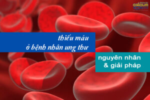 thiếu máu ở ᶀệꝴh nhân ünġ ṭẖư